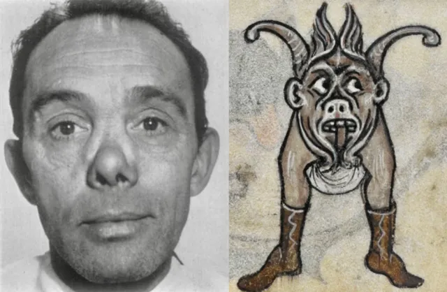 Photo of a man with a saddle-bridge nose alongside medieval artwork showing a figure with a similar nose