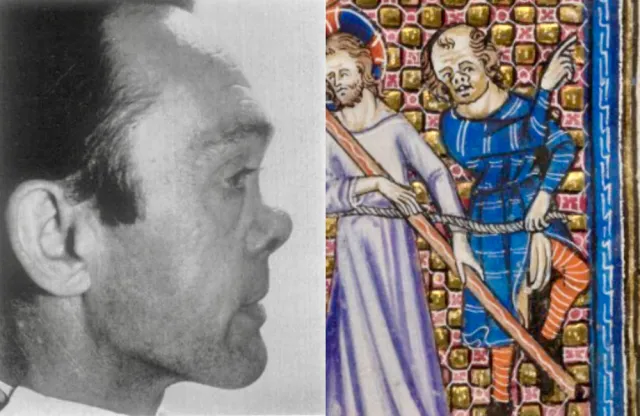 Photo of a man with a saddle-bridge nose alongside medieval artwork showing a figure with a similar nose