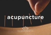 Self-Care at Smith: Acupuncture [extended hrs now available]